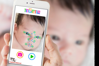 Yapay Zekâ, Nadir Hastalıklarla Mücadeleyi Yeniden Şekillendiriyor   